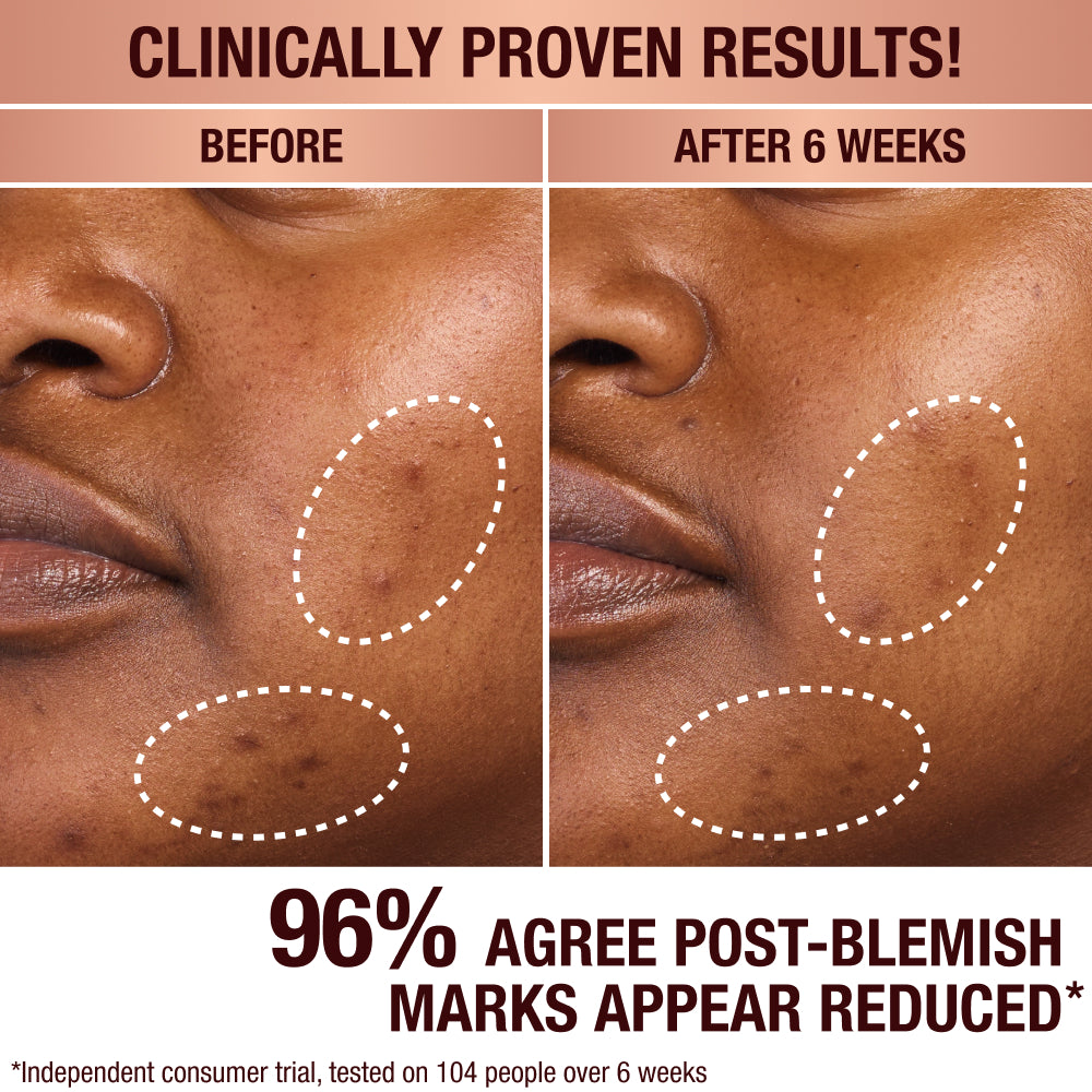 MINI DARK SPOT SERUM + CHARLOTTE’S MAGIC CREAM DUO