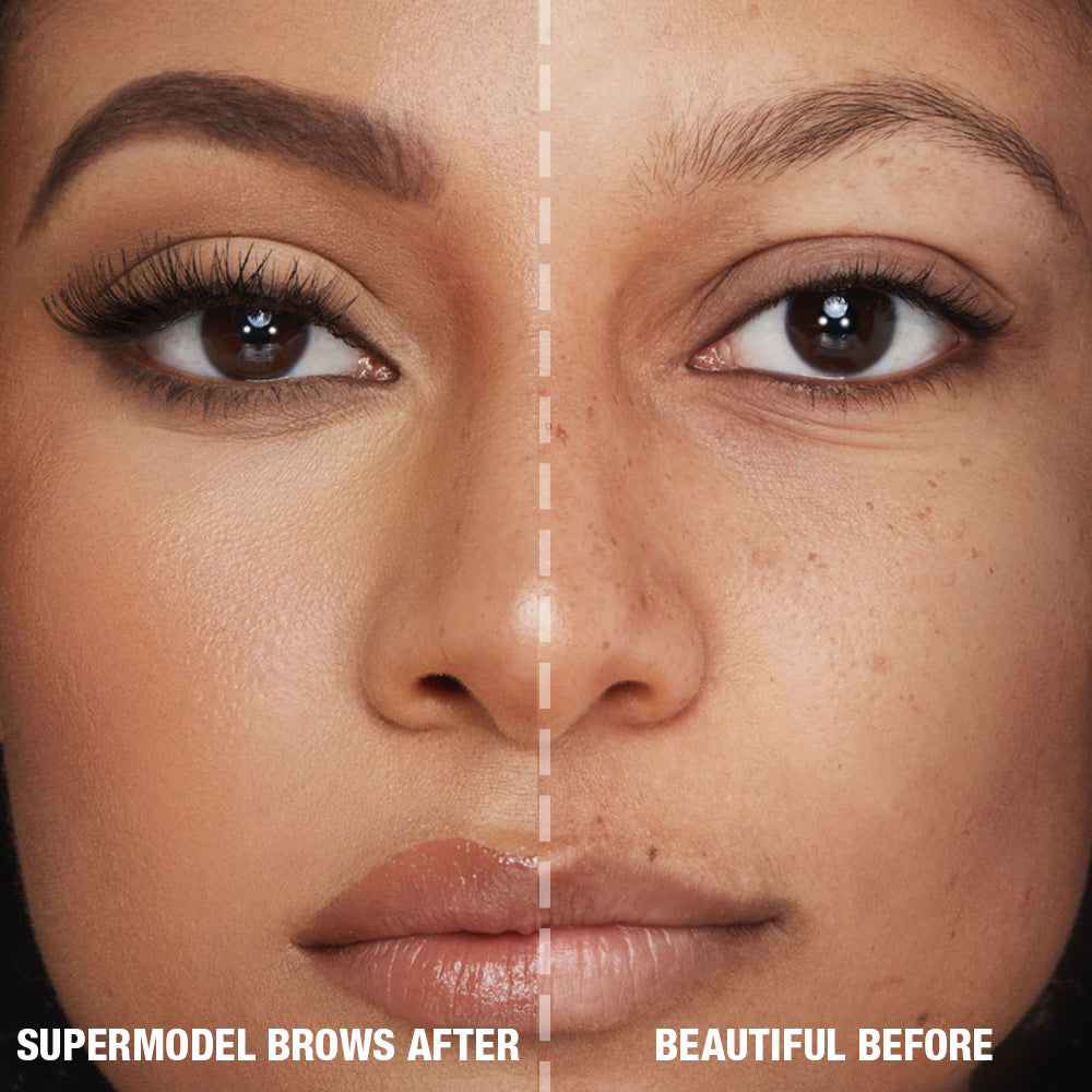 BROW LIFT